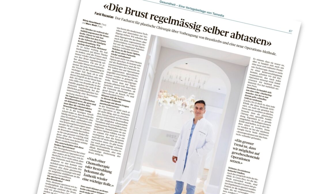 «Die Brust regelmässig selber abtasten»